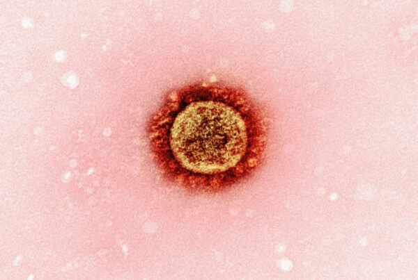Regulation Rigidity of the Immune System
