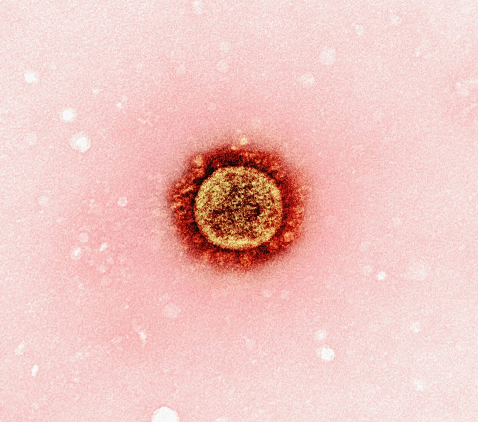 Regulation Rigidity of the Immune System