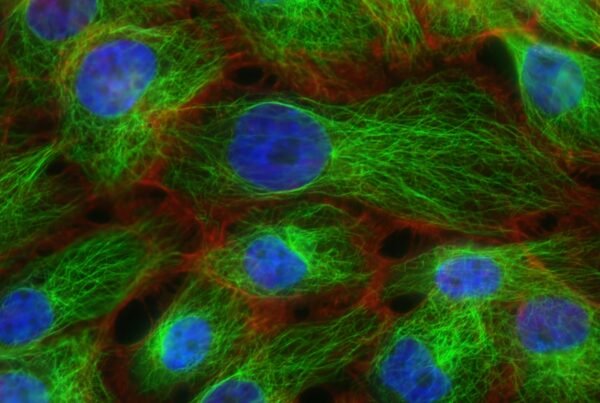 The Six Phase Table of Homotoxicology and Progression of Disease