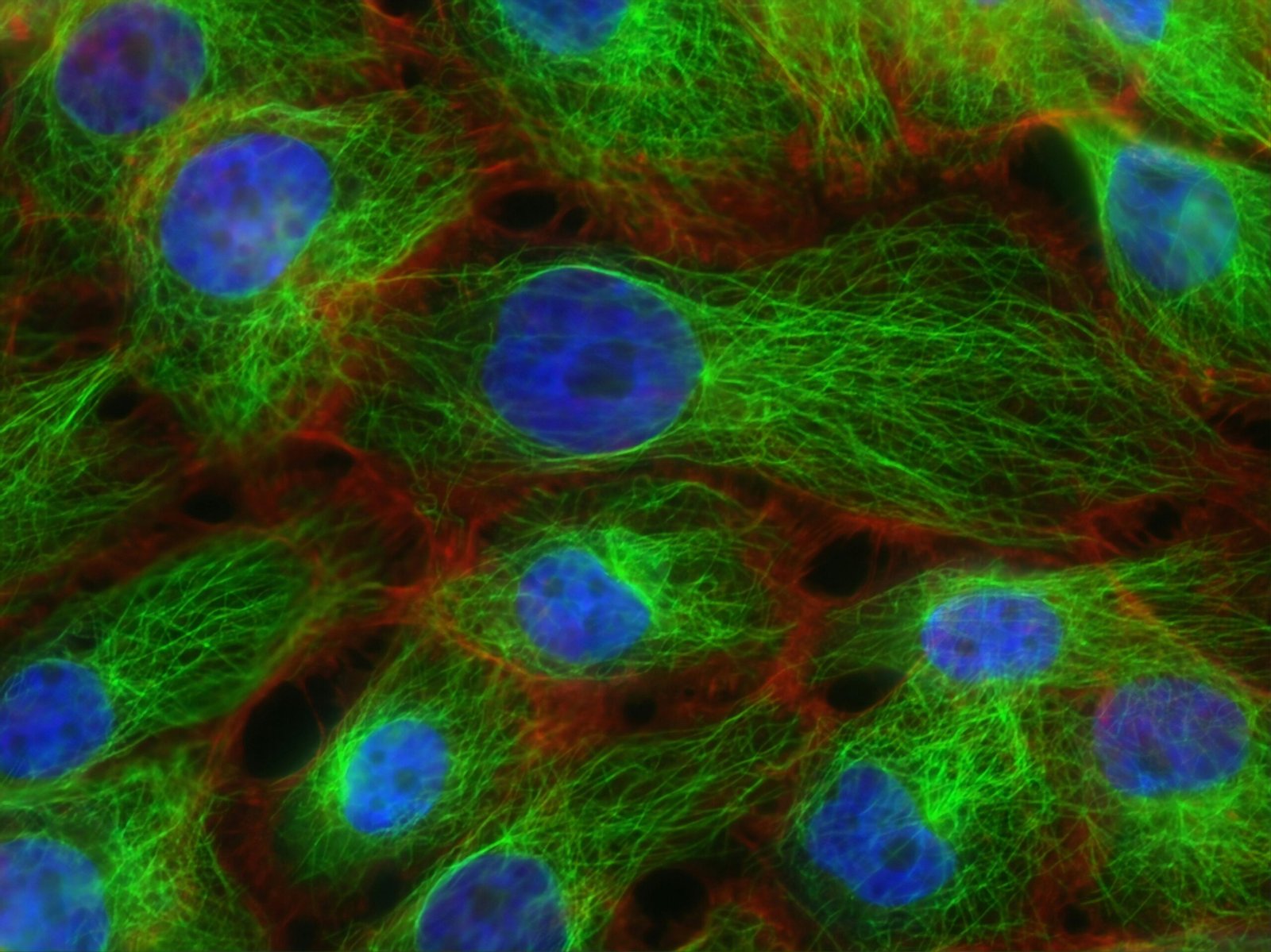 The Six Phase Table of Homotoxicology and Progression of Disease