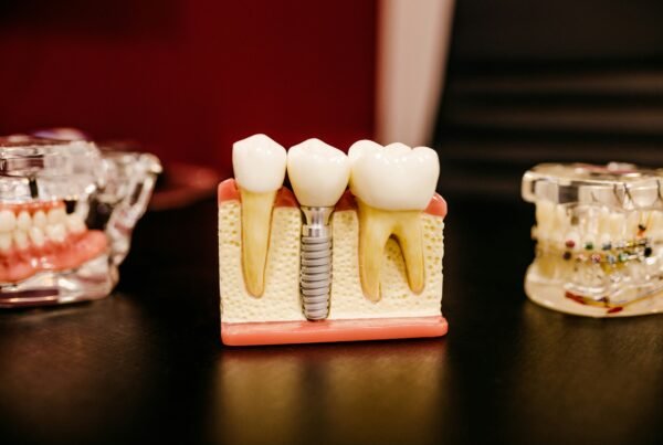 How Dental Work and Stress Can Affect the Microbiome